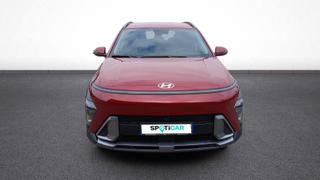 Hyundai Kona  - Creative - photo 1
