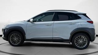 Hyundai Kona  - Creative - photo 1
