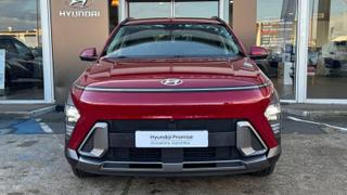 Hyundai Kona  - photo 1